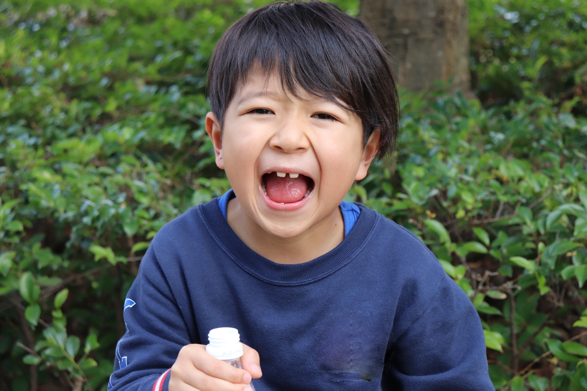 歯に隙間ができる原因は？すきっ歯の治療法や対策を解説